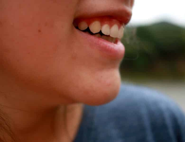 Régime anti-acné, comment ça marche ?