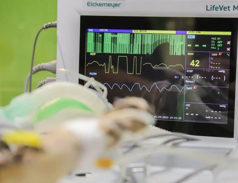 Les méthodes pour trouver un electrocardiographe de qualité