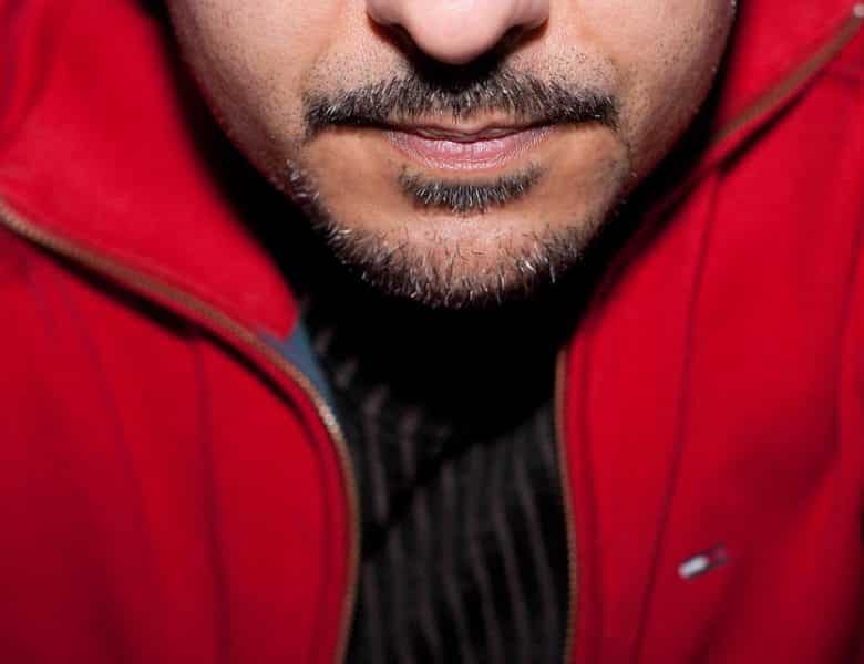 Qu’est-ce que la génioplastie ?