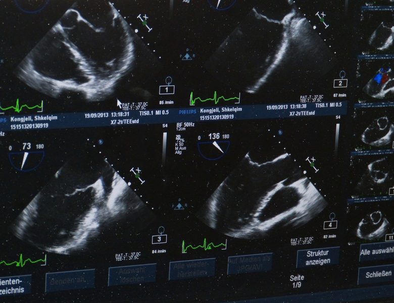 Quels examens peuvent être effectués avec un échographe professionnel ?