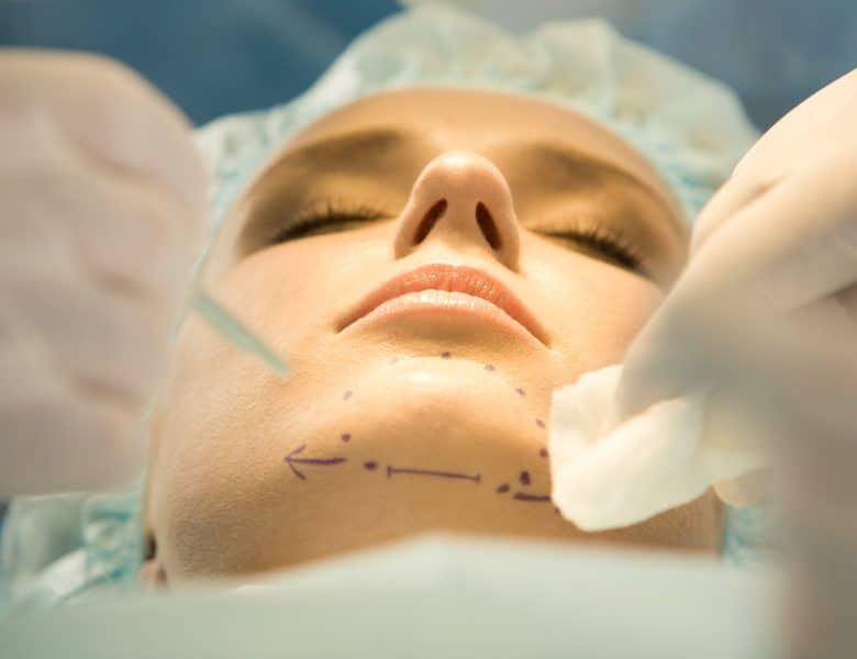 Comment enlever son menton en galoche ?