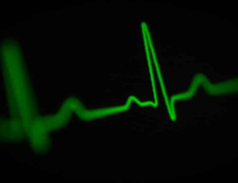 Les 4 avantages de la lecture d&rsquo;ecg à distance