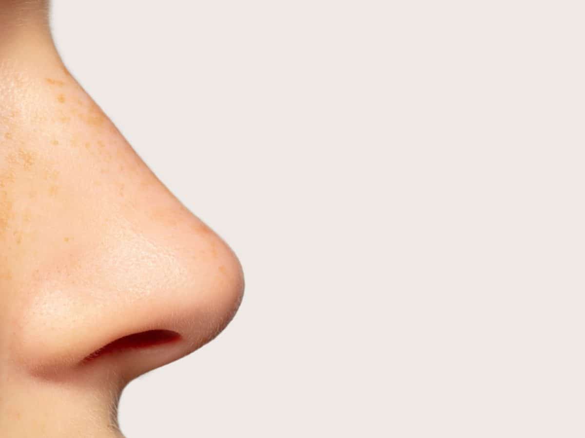 Les avantages de la rhinoplastie structurelle pour votre nez